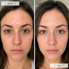 Maschera fototerapia LED viso anti-età 180 LED — specifiche tecniche nottesud