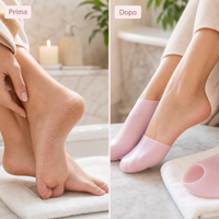 Talloni secchi prima e dopo self-care con calze gel rosa